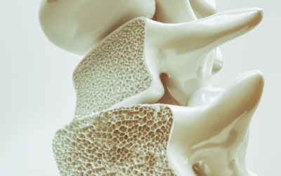 Treatment for Osteoporosis: The 5 Exercise Benefits You Need