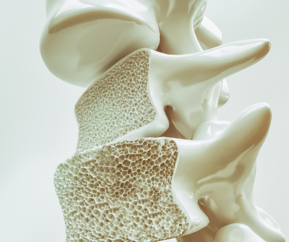 treatment for osteoporosis